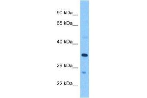 Host:  Rabbit  Target Name:  PSG2  Sample Tissue:  Human Breast Tumor  Antibody Dilution:  1ug/ml (PSG2 Antikörper)
