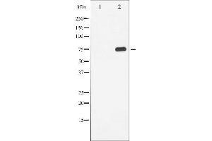 Western blot analysis of Tau phosphorylation expression in HeLa whole cell lysates,The lane on the left is treated with the antigen-specific peptide. (MAPT Antikörper  (pSer214))