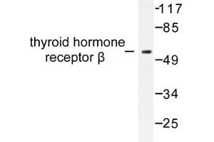 Image no. 1 for anti-Thyroid Hormone Receptor, beta (THRB) antibody (ABIN271853)