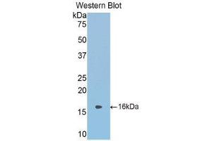 Western Blotting (WB) image for anti-serpin Peptidase Inhibitor, Clade A (Alpha-1 Antiproteinase, Antitrypsin), Member 6 (SERPINA6) (AA 268-391) antibody (ABIN1858272) (SERPINA6 Antikörper  (AA 268-391))