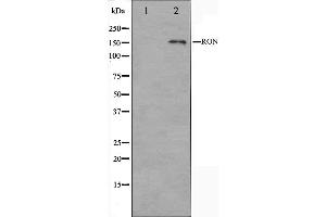 Western blot analysis on HeLa cell lysate using RON Antibody. (MST1R Antikörper  (C-Term))