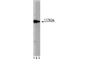 Western Blotting (WB) image for anti-Rabaptin, RAB GTPase Binding Effector Protein 1 (RABEP1) (AA 247-417) antibody (ABIN968104) (RABEP1 Antikörper  (AA 247-417))