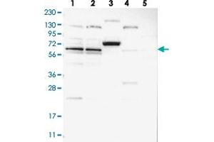ZNF324B Antikörper