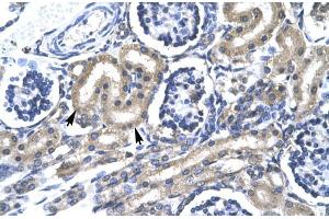 Human kidney; TRAFD1 antibody - C-terminal region in Human kidney cells using Immunohistochemistry (TRAFD1 Antikörper  (C-Term))