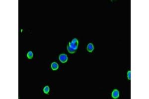 Immunofluorescent analysis of MCF-7 cells using ABIN7145091 at dilution of 1:100 and Alexa Fluor 488-congugated AffiniPure Goat Anti-Rabbit IgG(H+L) (ATG5 Antikörper  (AA 5-272))