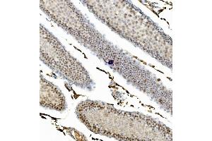 IHC analysis of CCNB1 using anti-CCNB1 antibody (ABIN7599335). (Cyclin B1 Antikörper  (AA 1-383))