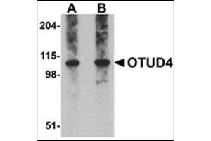 Western blot analysis of OTUD4 in Daudi cell lysate with this product at (A) 0. (OTUD4 Antikörper  (C-Term))
