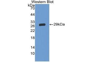 Detection of Recombinant GP5, Human using Polyclonal Antibody to Cluster of Differentiation 42d (CD42d) (GP5 Antikörper  (AA 17-242))