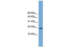 Image no. 1 for anti-Cbp/p300-Interacting Transactivator, with Glu/Asp-Rich Carboxy-terminal Domain, 4 (CITED4) (AA 51-100) antibody (ABIN6744592)