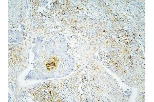 IHC analysis of ANXA3 using anti-ANXA3 antibody (ABIN6719269). (Annexin A3 Antikörper  (AA 23-323))