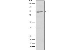 Western blot analysis of EIF2C3 expression in Human brain lysate. (Rekombinanter EIF2C3 Antikörper)
