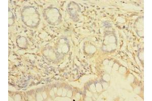 Immunohistochemistry of paraffin-embedded human small intestine tissue using ABIN7161555 at dilution of 1:100 (NHLRC2 Antikörper  (AA 1-367))