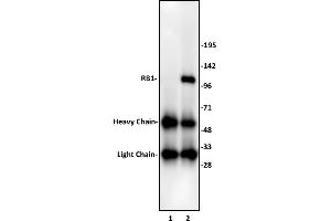 RB1 antibody (pAb) tested by Immunoprecipitation.