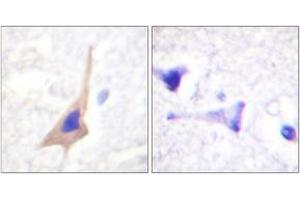 Immunohistochemistry analysis of paraffin-embedded human brain, using Tryptophan Hydroxylase (Phospho-Ser58) Antibody. (Tryptophan Hydroxylase 1 Antikörper  (pSer58))