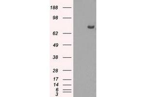 Image no. 15 for anti-P450 (Cytochrome) Oxidoreductase (POR) antibody (ABIN1497746) (POR Antikörper)
