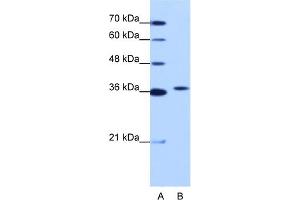 WB Suggested Anti-EXOSC7 Antibody Titration:  1. (EXOSC7 Antikörper  (N-Term))