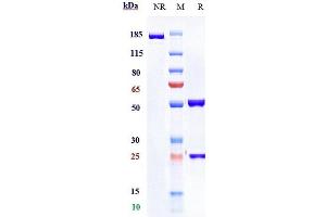 Anti- Human PD-1( Pembrolizumab) on SDS-PAGE under reducing (R) condition. (Rekombinanter PDCD1 (Pembrolizumab Biosimilar) Antikörper)