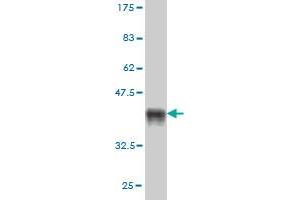 Western Blot detection against Immunogen (37. (SIM2 Antikörper  (AA 426-526))