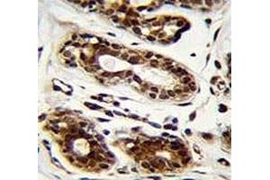 Nucleolin antibody immunohistochemistry analysis in formalin fixed and paraffin embedded human breast tissue.