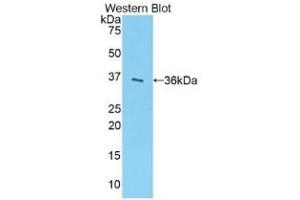 Western Blotting (WB) image for anti-Sulfotransferase Family, Cytosolic, 1A, Phenol-Preferring, Member 1 (SULT1A1) (AA 3-291) antibody (ABIN7437887)