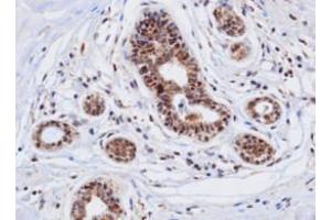 Immunohistochemistry (IHC) image for anti-Cathepsin D (CTSD) (AA 21-412) antibody (ABIN317502) (Cathepsin D Antikörper  (AA 21-412))