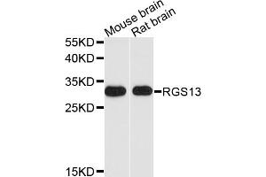 Western blot analysis of extracts of various cell lines, using RGS13 antibody. (RGS13 Antikörper)