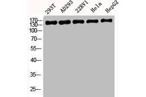 Western Blot analysis of 293T AD293 22RV1 HELA HepG2 cells using BAF170 Polyclonal Antibody