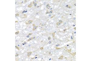 Immunohistochemistry of paraffin-embedded rat brain using RPLP1 antibody at dilution of 1:100 (x40 lens). (RPLP1 Antikörper)