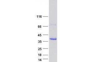 Western Blotting (WB) image for Ficolin (Collagen/fibrinogen Domain Containing Lectin) 2 (Hucolin) (FCN2) protein (Myc-DYKDDDDK Tag) (ABIN2721186)