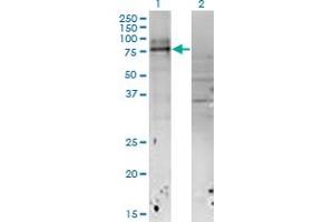 Western Blot analysis of IL18RAP expression in transfected 293T cell line by IL18RAP monoclonal antibody (M04), clone 4G4. (IL18RAP Antikörper  (AA 20-129))