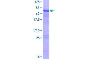 Image no. 1 for Actin-Related Protein 10 Homolog (ACTR10) (AA 1-417) protein (GST tag) (ABIN1305776) (ACTR10 Protein (AA 1-417) (GST tag))