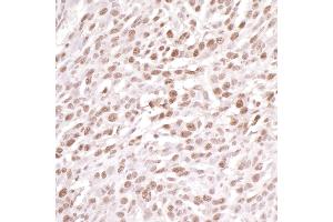 Immunohistochemistry (IHC) image for anti-Damage Specific DNA Binding Protein 1 (DDB1) (C-Term) antibody (ABIN7454634)