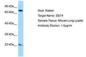 Image no. 1 for anti-Zinc Finger Protein 569 (ZNF569) (C-Term) antibody (ABIN6749864) (ZNF569 Antikörper  (C-Term))