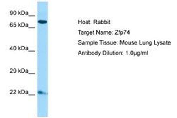 ZNF569 anticorps  (C-Term)