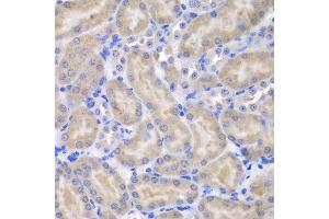 Immunohistochemistry (Paraffin-embedded Sections) (IHC (p)) image for anti-Alveolar Soft Part Sarcoma Chromosome Region, Candidate 1 (ASPSCR1) (AA 284-553) antibody (ABIN6137219)