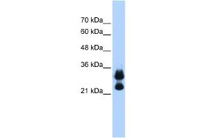 WB Suggested Anti-HIST1H1C Antibody Titration:  0. (HIST1H1C Antikörper  (Middle Region))