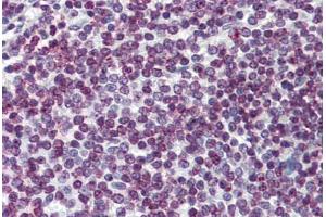 Human Spleen: Formalin-Fixed, Paraffin-Embedded (FFPE) (FOXO3 Antikörper  (AA 361-460))