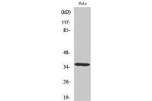 Western Blotting (WB) image for anti-Casein Kinase 1, alpha 1 (CSNK1A1) (Internal Region) antibody (ABIN3183657) (CSNK1A1 Antikörper  (Internal Region))