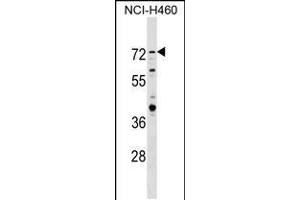 Western blot analysis in NCI-H460 cell line lysates (35ug/lane). (RNF207 Antikörper  (C-Term))