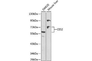 Western blot analysis of extracts of various cell lines, using CES2 antibody (ABIN3022047, ABIN3022048, ABIN3022049 and ABIN6218583) at 1:1000 dilution. (CES2 Antikörper  (AA 310-410))