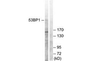 Western blot analysis of extracts from A549 cells, using 53BP1 (Ab-6) Antibody. (TP53BP1 Antikörper  (AA 1-50))
