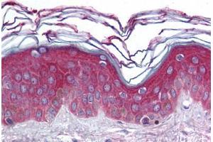 Human Skin (formalin-fixed, paraffin-embedded) stained with ARHGEF11 antibody ABIN296726 at 10 ug/ml followed by biotinylated goat anti-rabbit IgG secondary antibody ABIN481713, alkaline phosphatase-streptavidin and chromogen. (ARHGEF11 Antikörper  (AA 1-50))