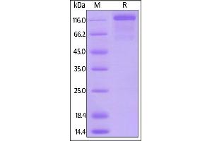 SDS-PAGE (SDS) image for Fms-Related Tyrosine Kinase 4 (FLT4) (AA 25-770) (Active) protein (Fc Tag) (ABIN5954972)