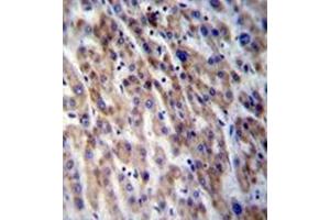 Formalin fixed and paraffin embedded human liver tissue stained with CPN1 Antibody (Center) followed by peroxidase conjugation of the secondary antibody and DAB staining.
