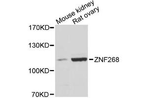 Western blot analysis of extracts of various cell lines, using ZNF268 antibody. (ZNF268 Antikörper)