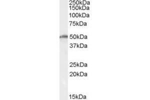 Western Blotting (WB) image for anti-DEAD (Asp-Glu-Ala-As) Box Polypeptide 19B (DDX19B) (AA 408-422) antibody (ABIN292539)