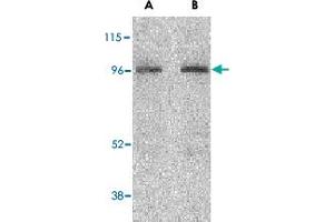 Western blot analysis of NOD2 in HeLa cell lysate with NOD2 polyclonal antibody  at (A) 2 and (B) 4 ug/mL . (NOD2 Antikörper  (C-Term))