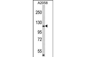 Western blot analysis of HMHA1 Antibody in A2058 cell line lysates (35ug/lane) (HMHA1 Antikörper  (AA 877-903))
