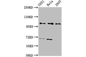 Western Blot Positive WB detected in: U251 whole cell lysate, Hela whole cell lysate, 293T whole cell lysate All lanes: PRPF40A antibody at 2.