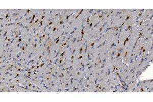 IHC analysis of Alpha B Crystallin/CRYAB using anti-Alpha B Crystallin/CRYAB antibody (ABIN7601209). (CRYAB Antikörper  (AA 30-151))